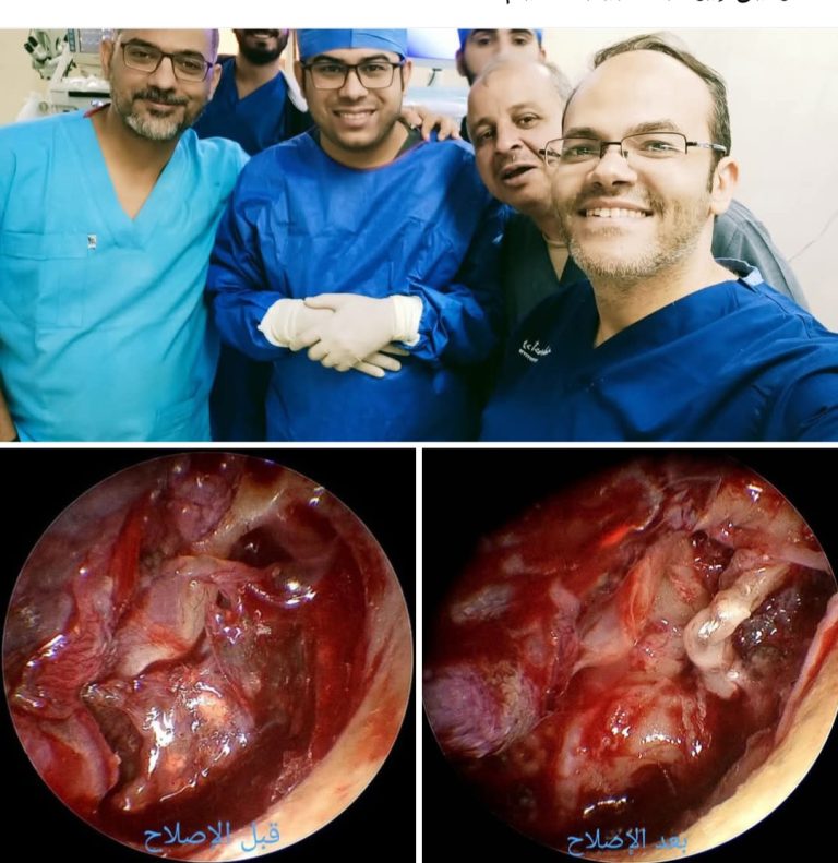 بمستشفى سوهاج الجامعي ..فريق طبي يجري تدخل جراحي دقيق بالأذن لمصاب فلسطيني اصيب بشظايا جراء العدوان على غزة