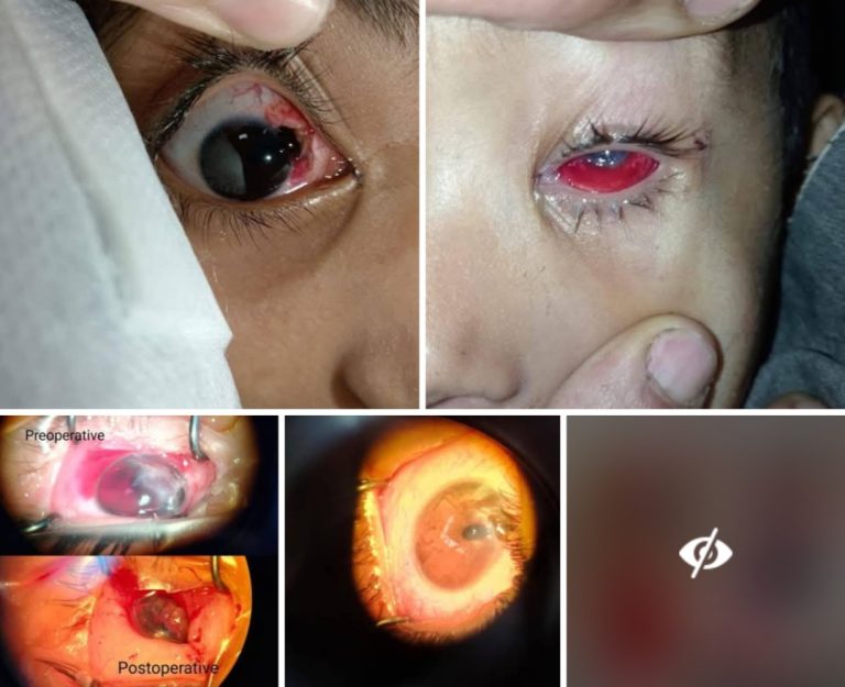 مستشفى سوهاج الجامعي في مواجهة كارثة الألعاب النارية “بين فرحة العيد وآلام المرضى.. أطباء سوهاج الجامعي يسطرون أروع معاني الإنسانية